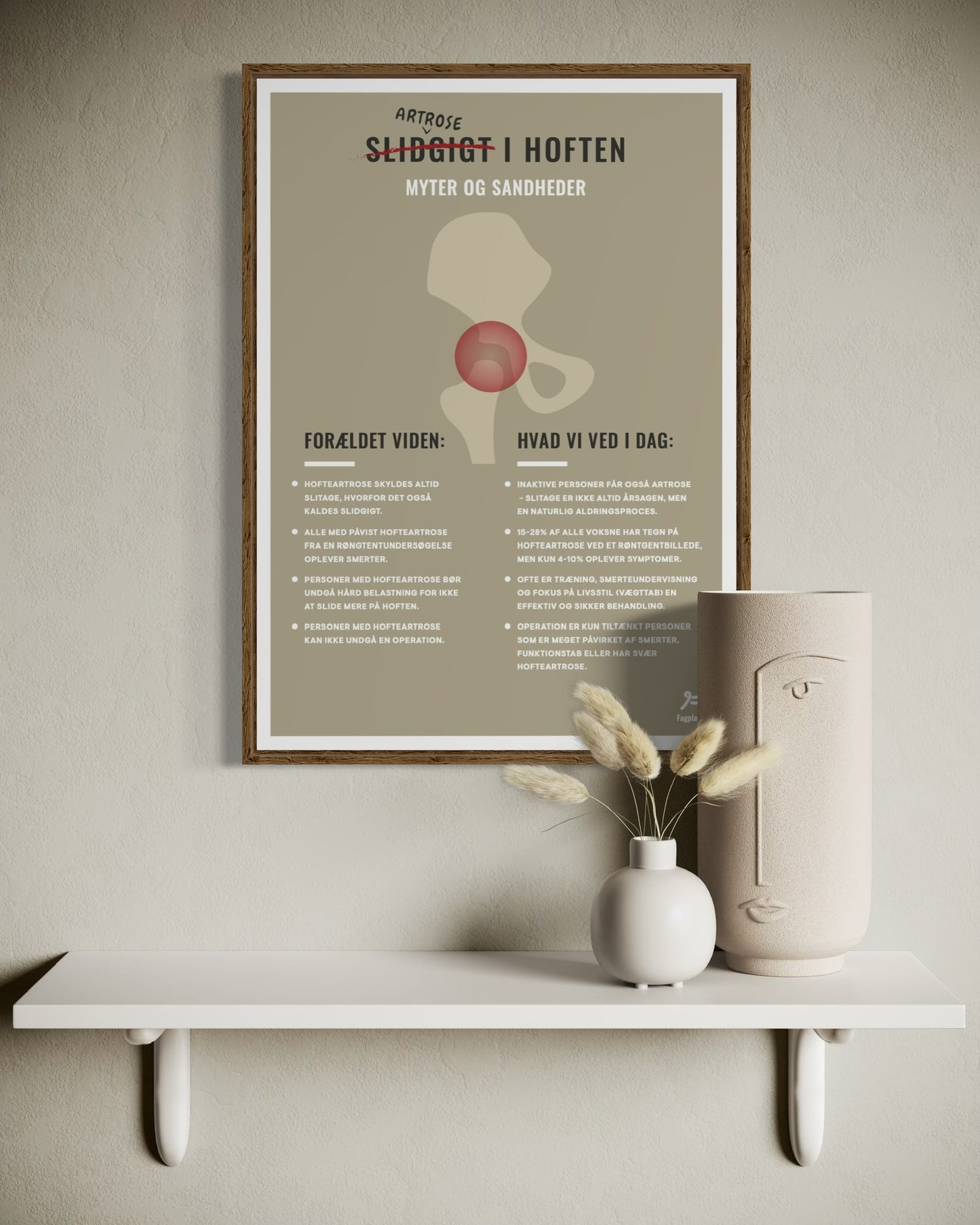 Fagplakat | Artrose I Hoften