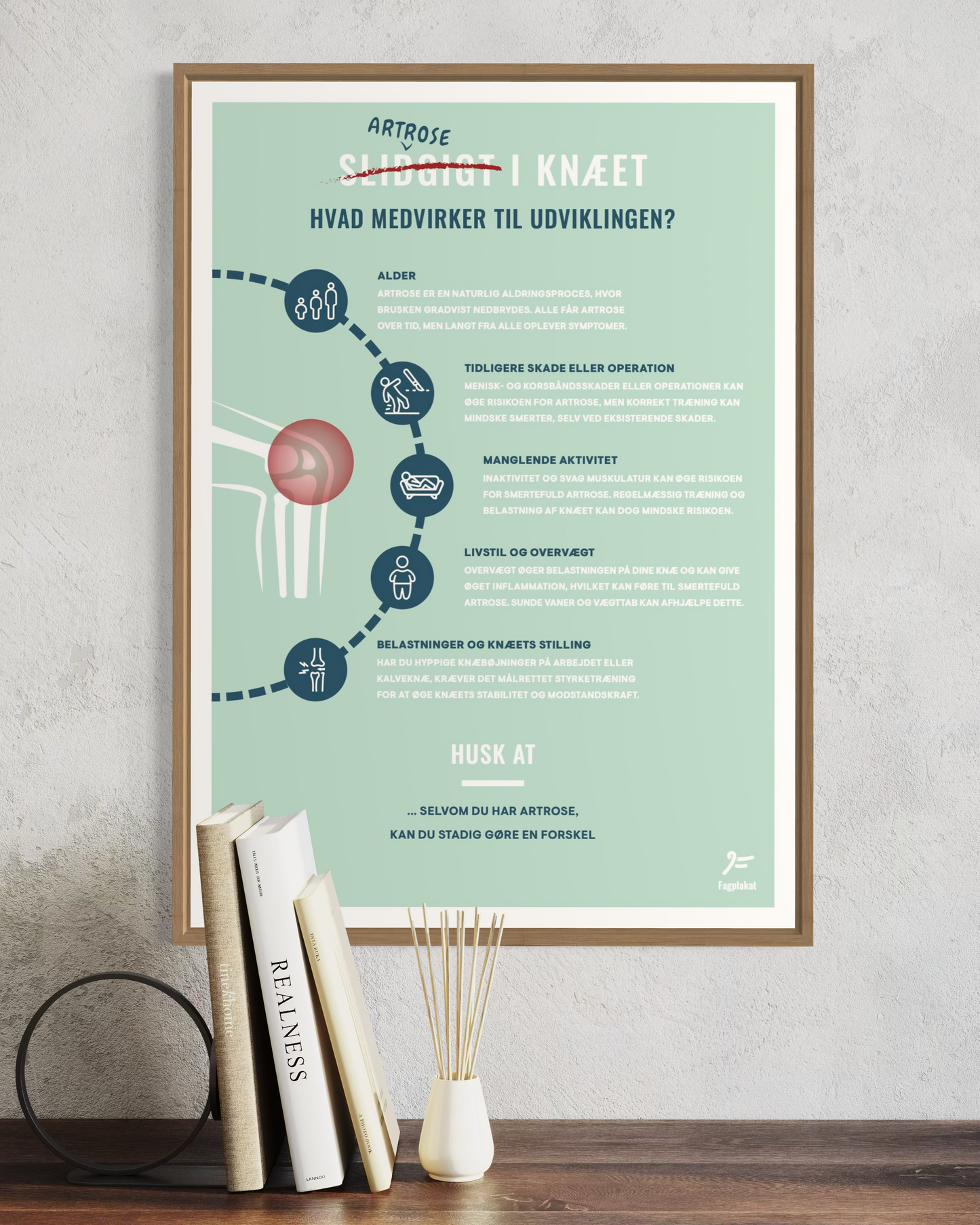 Fagplakat | Artrose I Knæet